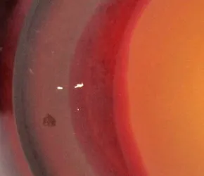 査定ポイント2.サイズと状態の確認 エミール・ガレ状態